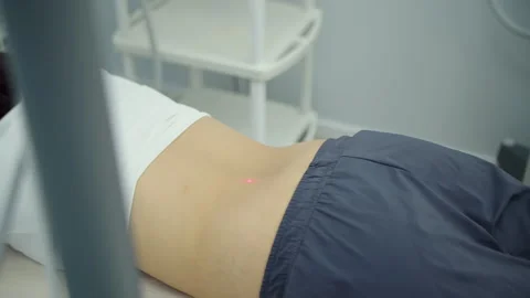 Laser physiotherapy warming lower back area Stock Footage 325853210