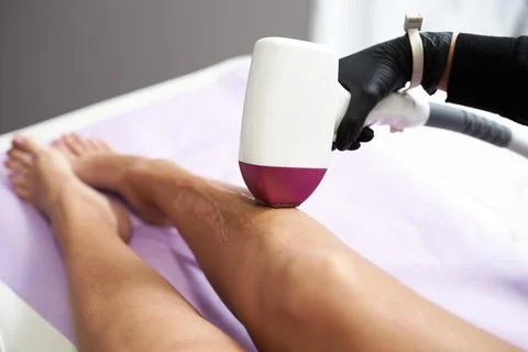 Laser procedure Stock Photos