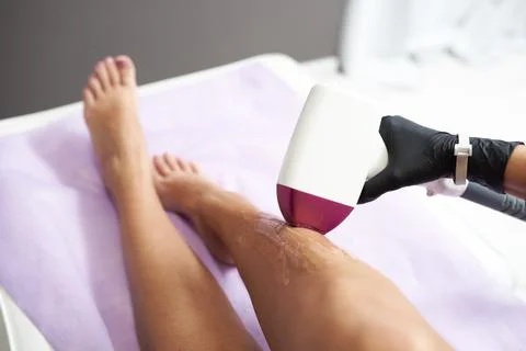 Laser procedure Stock Photos