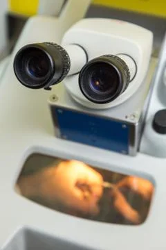 Laser processing for dental prosthesis Stock Photos