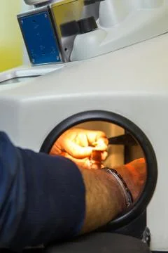 Laser processing for dental prosthesis Stock Photos