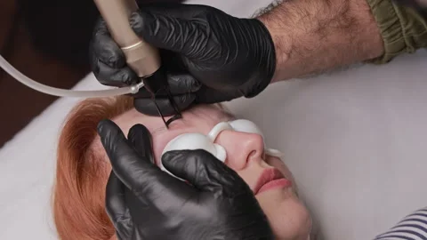 Laser removal of permanent eyebrow makeup tattoo on woman wearing protective eye Stockbeeldmateriaal 343415428
