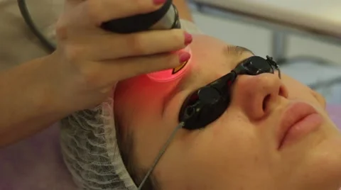 Laser resurfacing facial Stock Footage 46824088