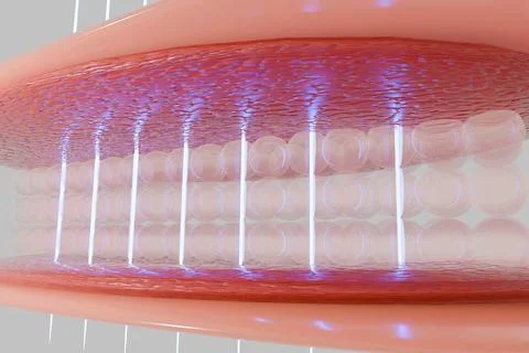 Laser shot through skin layer to collagen for Saggy skin and Facial treatmen Stock Illustration