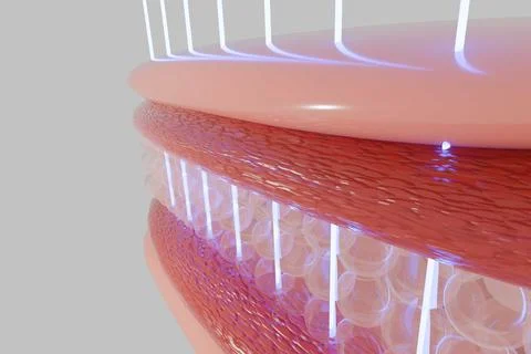 Laser shot through skin layer to collagen for Saggy skin and Facial treatmen Stock Illustration