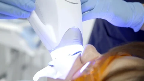 Laser Teeth Whitening Video stock 97844793