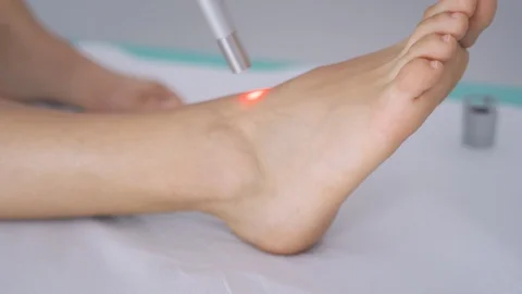 Laser therapy treatment of ankle joint Stock Footage