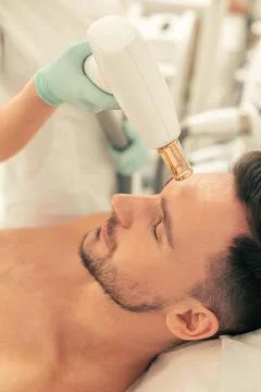 Laser tool for the stretch marks removal procedure Stock Photos