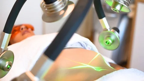Laser treatment Stock Footage 108432929