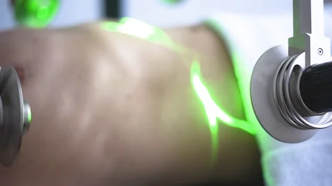 Laser treatment Stock-Footage 108433054