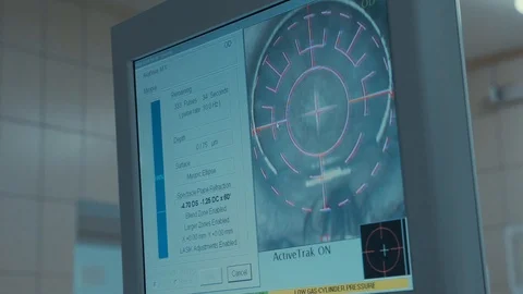 Laser vision correction. A patient in the operating room during ophthalmic Stock Footage 102828330