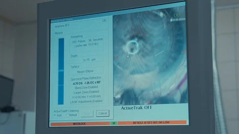 Laser vision correction. A patient in the operating room during ophthalmic Stock Footage 102829432