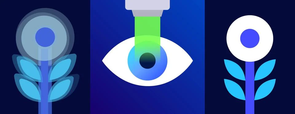 Lasik eye surgery Stockillustratie