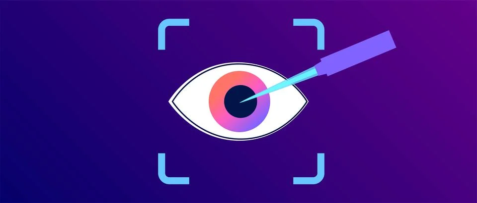 Lasik eye surgery Stockillustratie