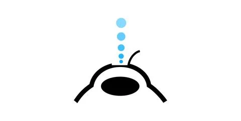 Lasik eye surgery Illustrazione stock