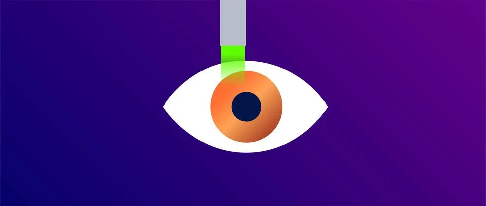 Lasik eye surgery 库存插图