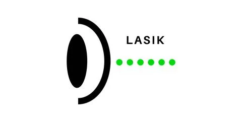 Lasik eye surgery Illustrazione stock