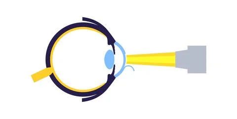 Lasik eye surgery Stock Illustration