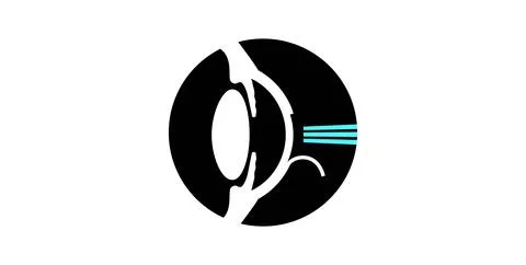 Lasik eye surgery Illustrazione stock