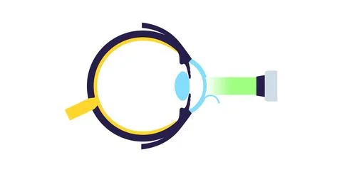Lasik eye surgery 库存插图