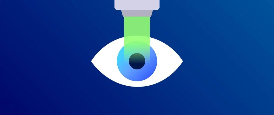 Lasik eye surgery 库存插图