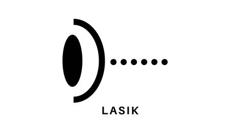 Lasik eye surgery Stock Illustration