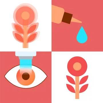 Lasik eye surgery 库存插图