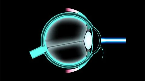 LASIK eye surgery Illustrazione stock