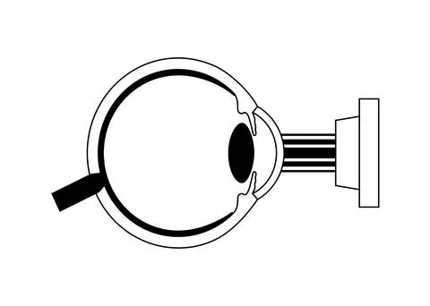 LASIK eye surgery イラスト素材
