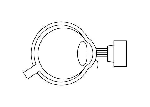LASIK eye surgery Illustrazione stock