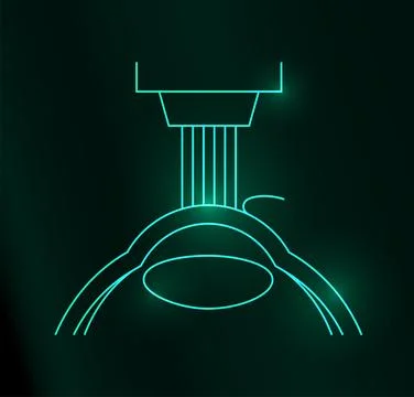 LASIK eye surgery Stock Illustration