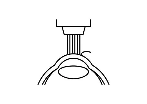 LASIK eye surgery Illustrazione stock
