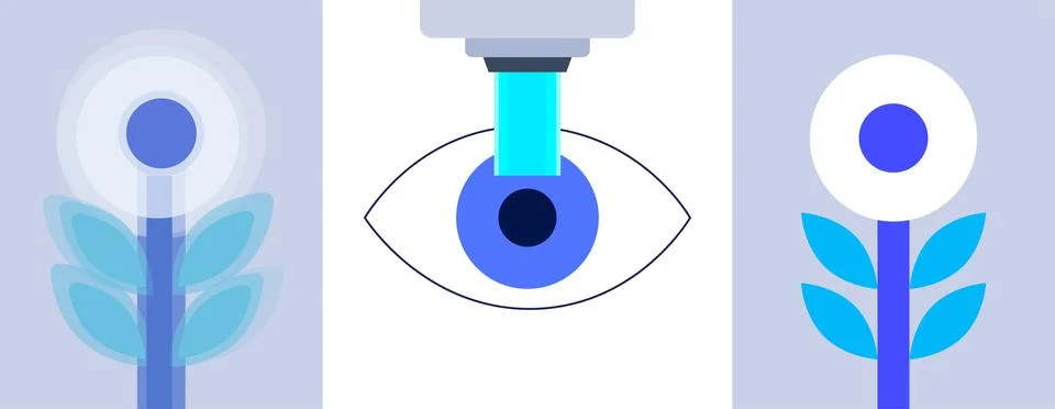 LASIK eye surgery Illustrazione stock