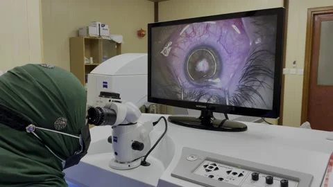 Lasik operation for treating refractive errors Stock Footage 158909289