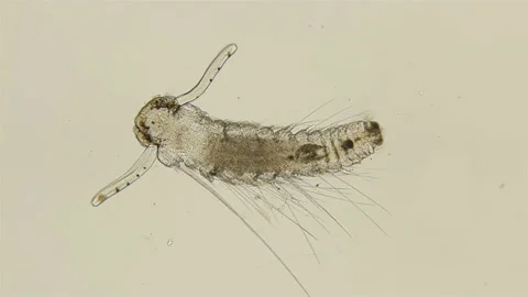 Late-stage worm larva Nektoheta under a microscope, family Spionidae, class Stock Footage 125270953