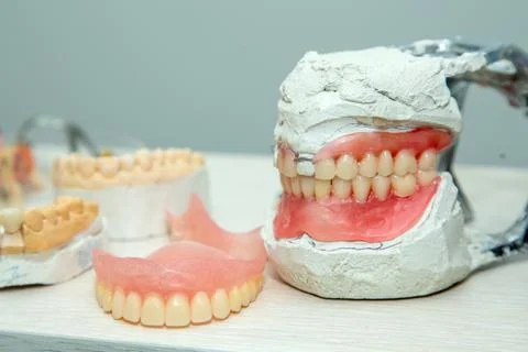 Layout of teeth on the table dental impression Stock Photos