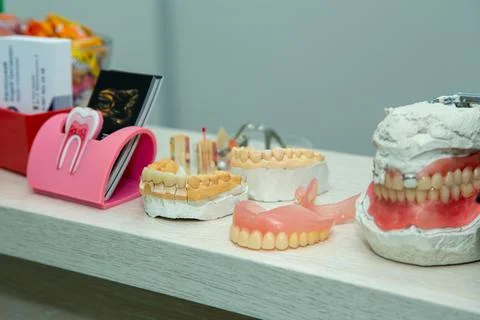 Layout of teeth on the table dental impression Stock Photos