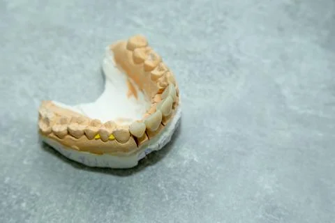 Layout of teeth on the table Stock Photos