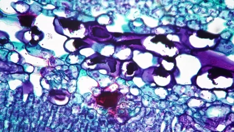 Leaf of Jasminum nudiflorum in transversal section under microscope 400x against Stock Footage 208403661