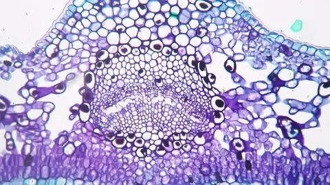 Leaf of Jasminum nudiflorum TS under microscope 200x against bright field Stock Footage 212759713