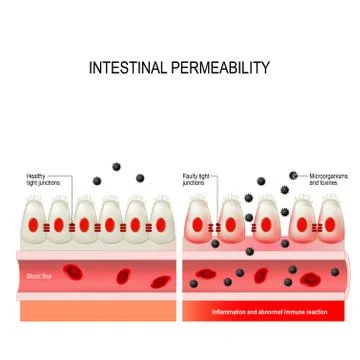 Leaky gut. Intestinal permeability Stock Illustration