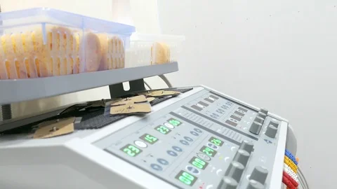 LED screens and knobs on thermotherapy and diathermy machine 스톡 동영상 85132279