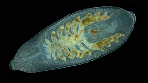 Leech Alboglossiphonia sp. under a microscope, family Glossiphoniidae Stock Footage 155735573