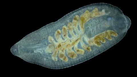 Leech Alboglossiphonia sp. under a microscope, family Glossiphoniidae, orde.. Foto stock