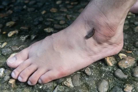 Leech attach biting on leg in tropical forrest Stock Photos