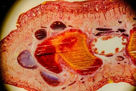 Leech cross section showing internal anatomical structures staine 스톡 사진