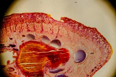 Leech cross section showing internal anatomical structures staine Stock Photos