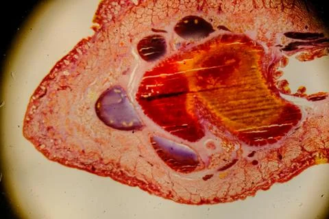 Leech cross section showing internal anatomical structures staine Fotos de archivo