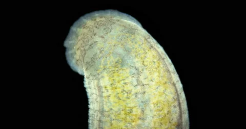 Leech family Erpobdellidae under a microscope, Arhynchobdellida. Erpobdella sp. Stock Footage 236686413