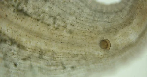Leech family Glossiphoniidae under a microscope. Video stock 159362211